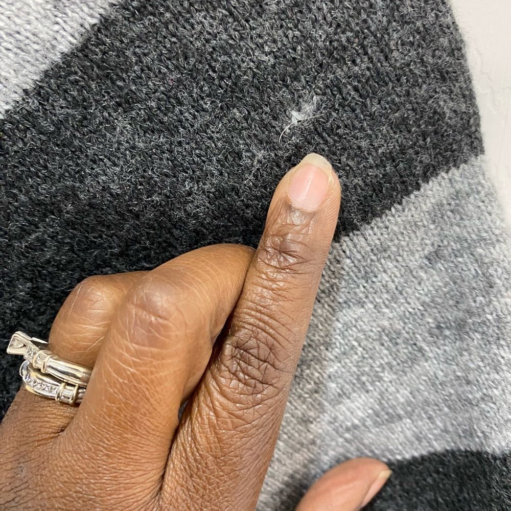 Fenn Wright Manson short sleeve grey striped turtleneck sweater with pockets - Picture 6 of 11